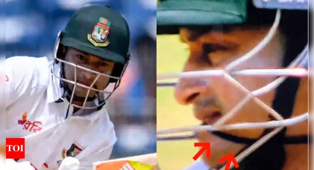EXPLAINED: Why Bangladesh batsman Shakib Al Hasan is holding a band between his teeth while batting | Cricket News EXPLAINED: Why Bangladesh batsman Shakib Al Hasan is holding a band between his teeth while batting | Cricket News
